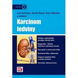 kolektiv autorů: Karcinom ledviny